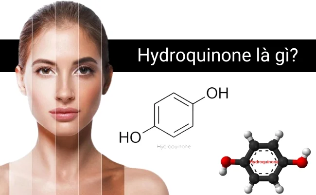 hydroquinone-tri-nam