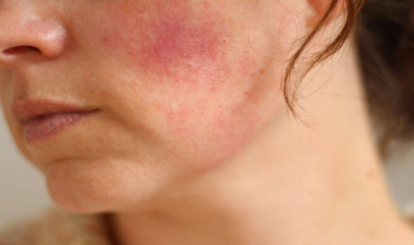 da-do-khi-suy-yeu-hang-rao-bao-ve